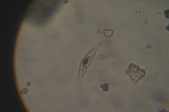 Cymbella