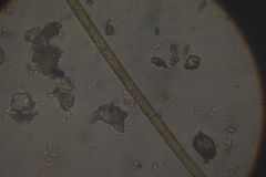 Aulacoseira