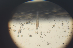 Dissotrocha macrostyla