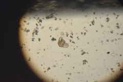 Dissotrocha macrostyla