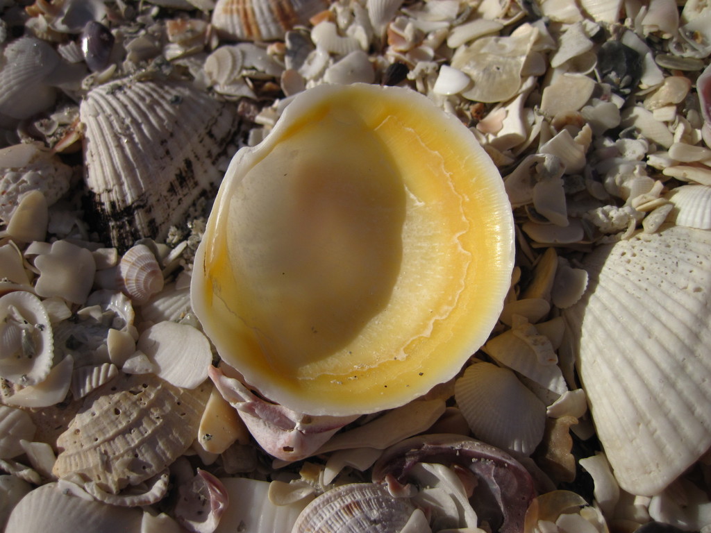 Anodontia
