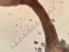 Phaeocalicium populneum