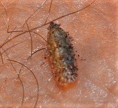 Plectoderini