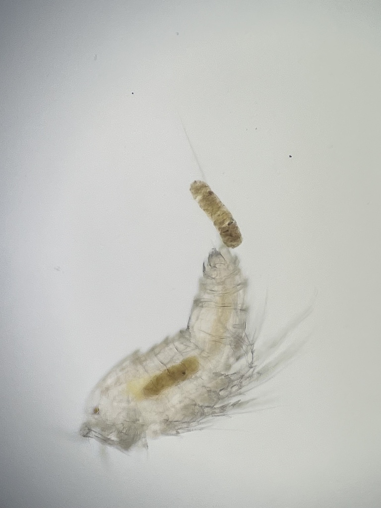 Bryocamptus pygmaeus pygmaeus