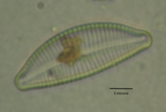 Cymbella