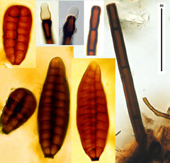 Tretospeira