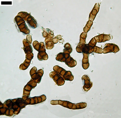 Trimmatostroma salicis