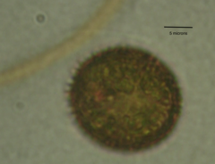 Trachelomonas robusta