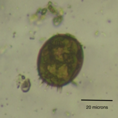 Trachelomonas armata