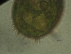 Trachelomonas armata