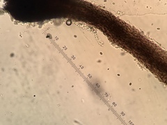 Chaenothecopsis savonica