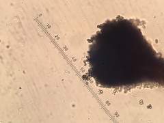 Chaenothecopsis savonica
