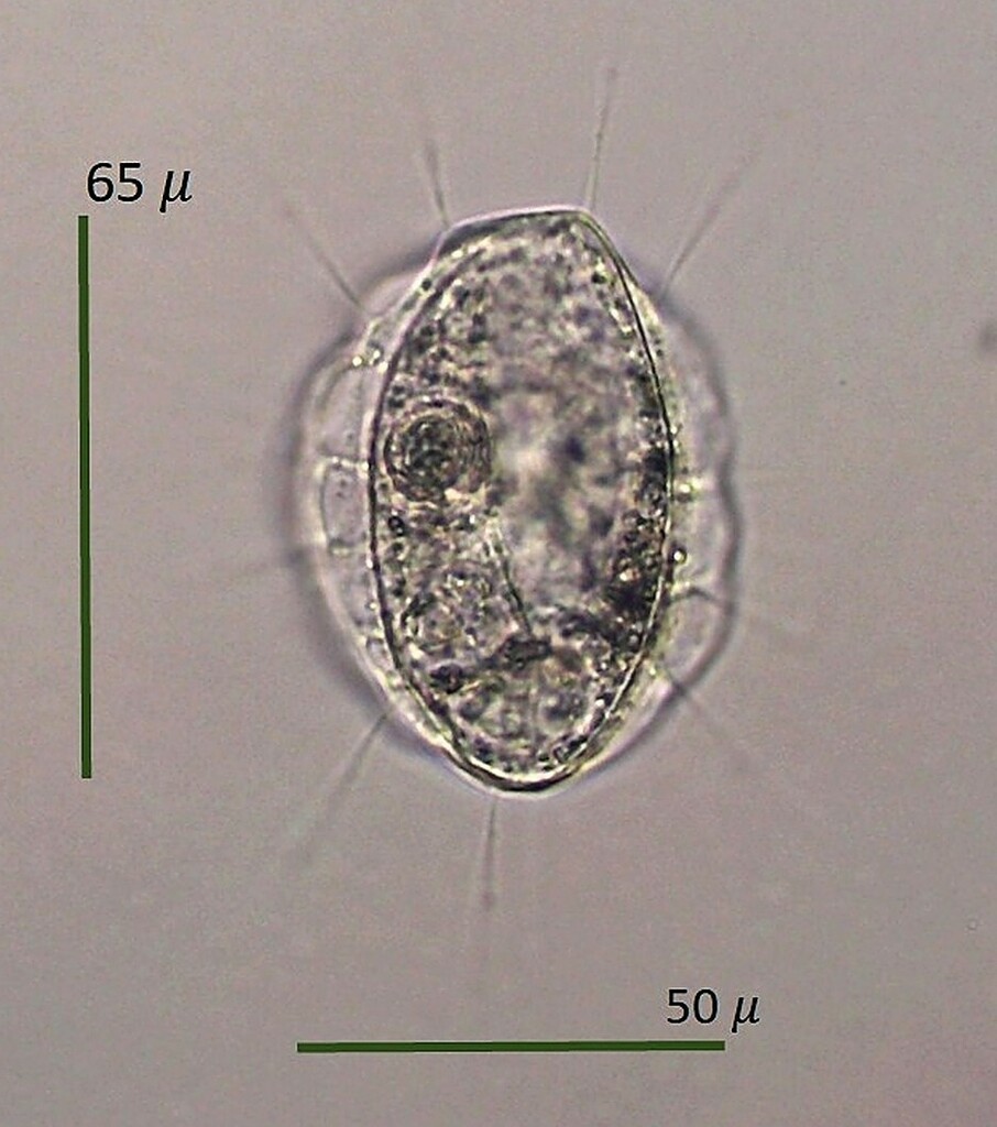 Actinosphaerium from Victory, VT, USA Sample4 Site Victory Basin