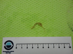 Aeginina longicornis