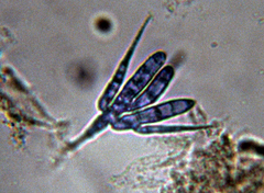 Tetracladium setigerum