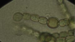 Anabaena