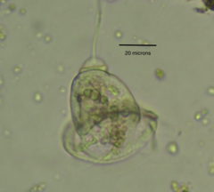 Vorticella