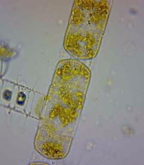 Stephanopyxis palmeriana