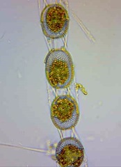 Stephanopyxis nipponica