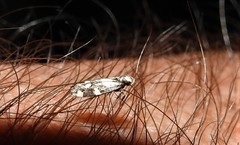 Limnaecia tetraplanetis