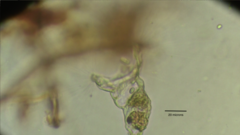 Collotheca