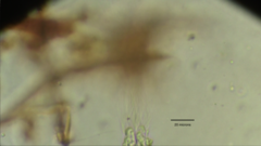 Collotheca
