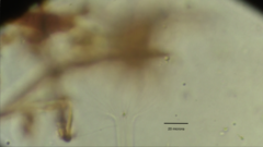 Collotheca