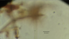 Collotheca