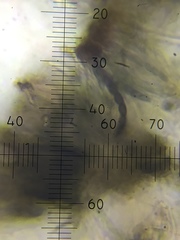 Mycocalicium subtile