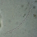 Spirochaetae - Photo (c) Zihao Wang, some rights reserved (CC BY), uploaded by Zihao Wang