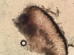 Lecidella enteroleucella