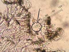 Lecidella enteroleucella