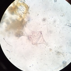 Protoperidinium
