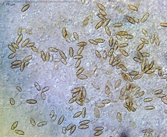 Xerocomus squamulosus