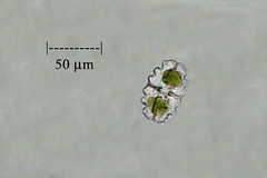Desmidiaceae
