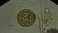 Trachelomonas volvocina