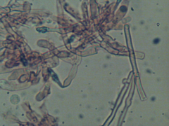 Hyphodontia arguta