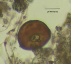 Arcella hemisphaerica