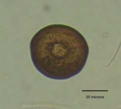 Arcella hemisphaerica