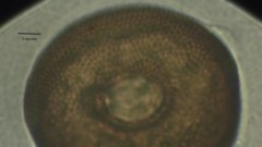 Arcella hemisphaerica