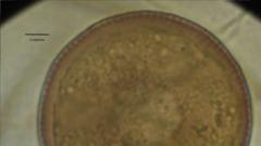 Arcella hemisphaerica