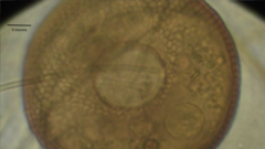 Arcella hemisphaerica