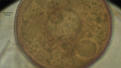 Arcella hemisphaerica