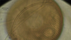 Arcella hemisphaerica