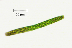 Pleurotaenium trabecula