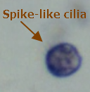 Entamoeba coli