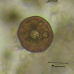 Arcella hemisphaerica