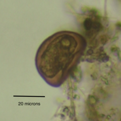 Arcella hemisphaerica