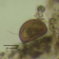 Arcella hemisphaerica