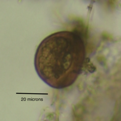 Arcella hemisphaerica